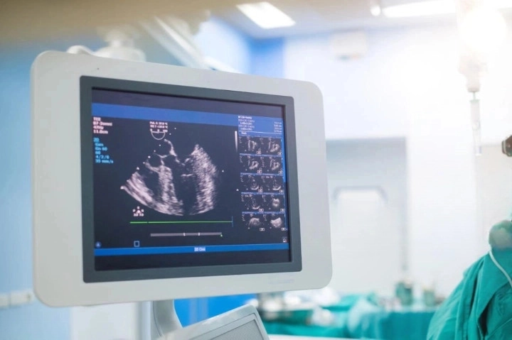 УЗИ сердца, УЗИ сердца (эхокардиография) в Одессе в клинике Профмед